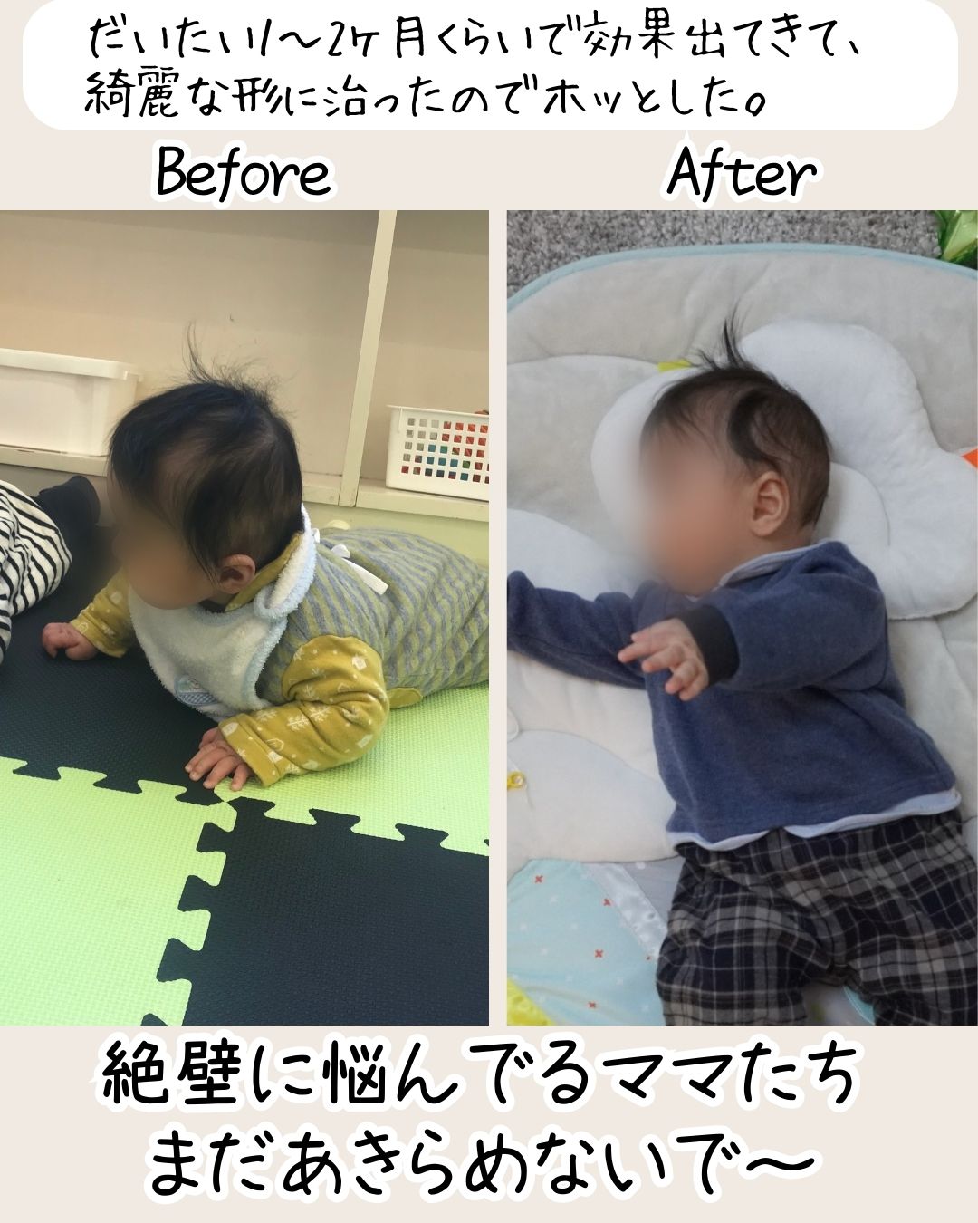 赤ちゃんの枕による効果